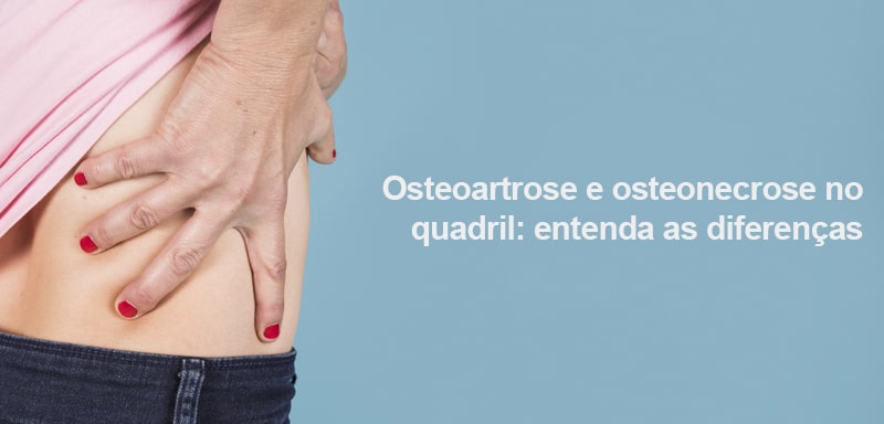 Osteoartrose E Osteonecrose No Quadril Entenda As Diferen As